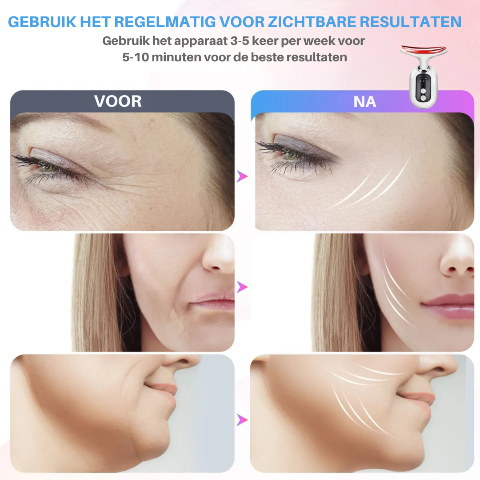 SkinPro Lift gezicht laser