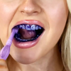 SparklePro™ Teeth Whitener